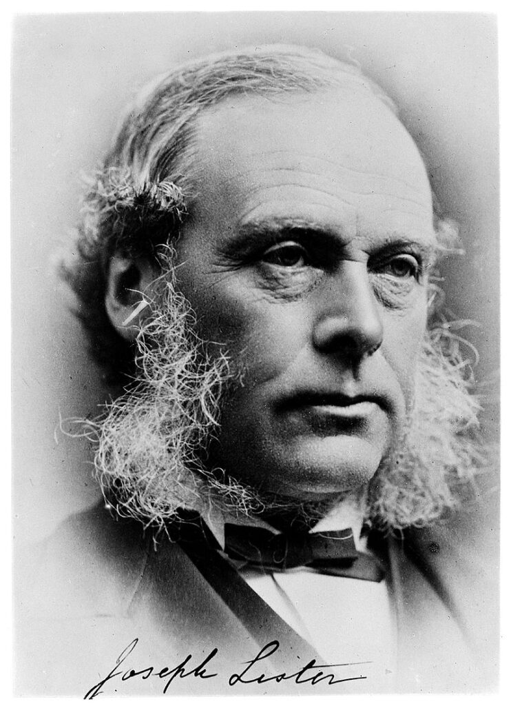 хирургия, Бащата на асептичната хирургия, Джоузеф Листър. Joseph Lister, Antyseptyka, Chirurgia, Dezynfekcja ran 